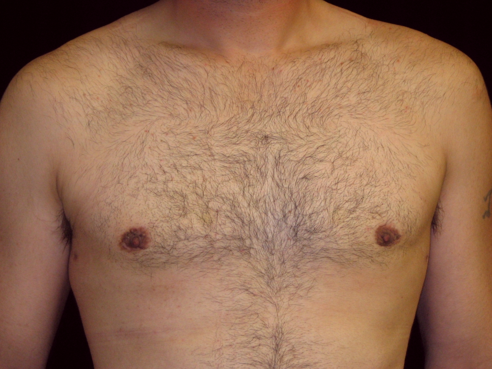 изменение груди у мужчин фото 96